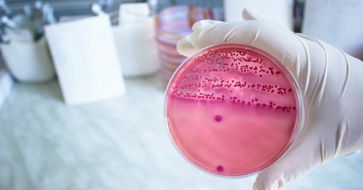 Los aditivos antibacteriales es una de la nueva tendencia del 2021